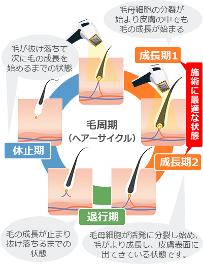 【皮膚科医が解説】医療レーザー脱毛の効果が 出る回数は？部位別の脱毛効果と回数目安について