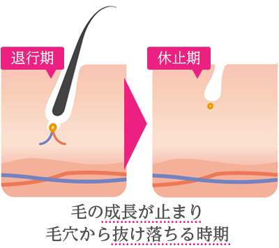 退行期・休止期は毛の成長が止まり毛穴から抜け落ちる時期