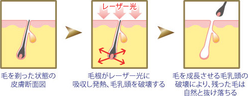 成長期　毛が成長している時期　退行期　毛の成長が止まっている時期　休止期　毛が抜け落ちる時期