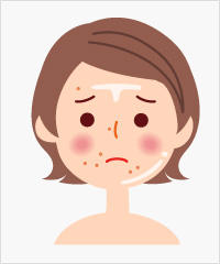 脂性肌の方