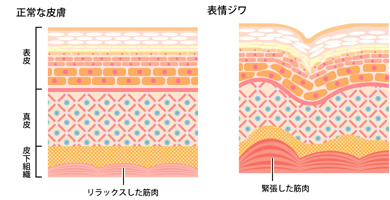 表情ジワ