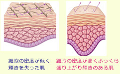 ヒアルロン酸注射:肌密度を高めるとは?