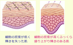 ヒアルロン酸注射：肌密度を高めるとは？