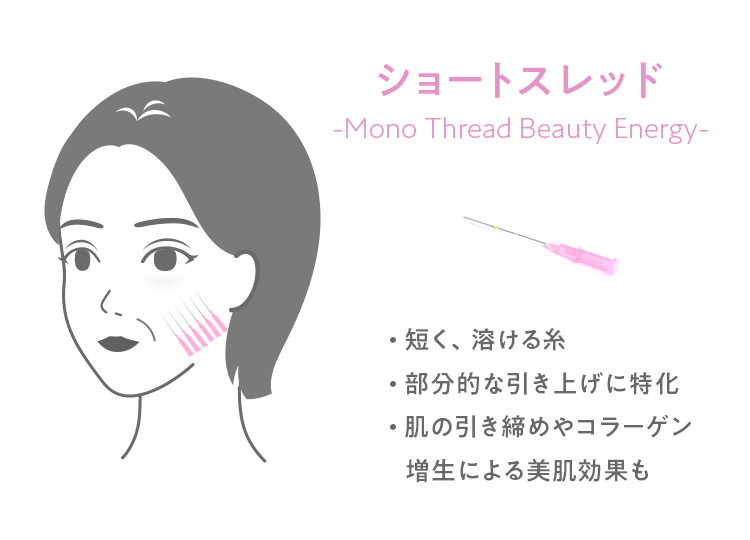 ショートスレッド