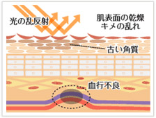 くま