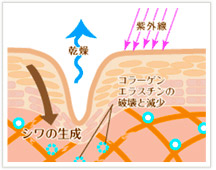 しわ・小じわの原因