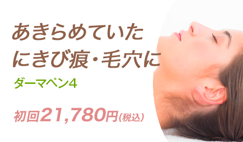 ダーマローラー/ダーマペン4