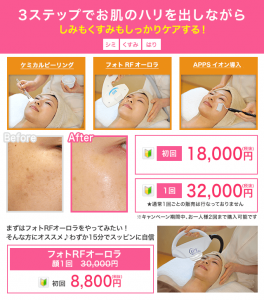 ハリ艶を取り戻す はりUPコース